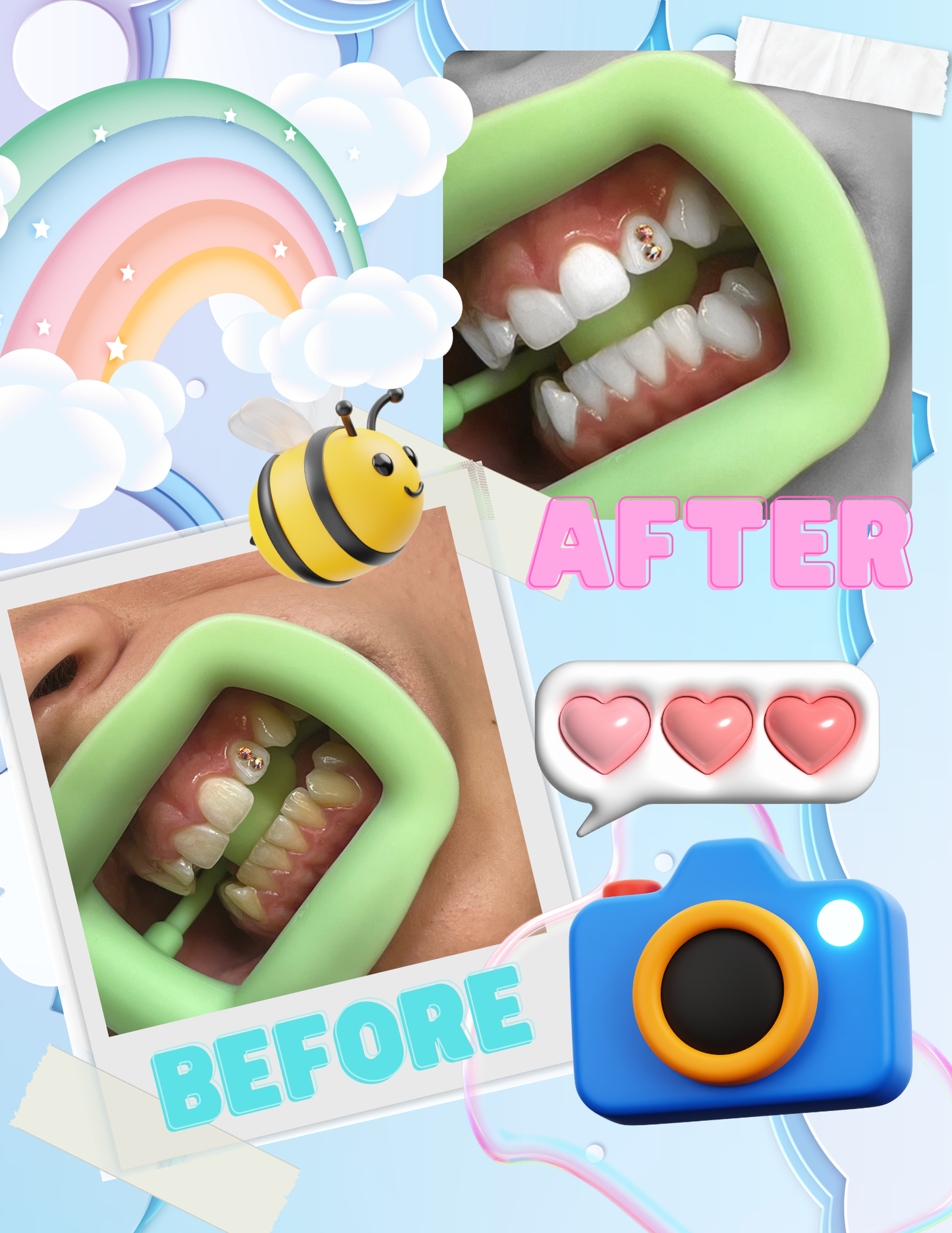 Tooth Gem Training + Photo Editing